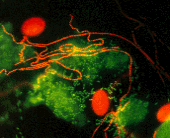 Microscopic bacteria Microscopic bacteria
